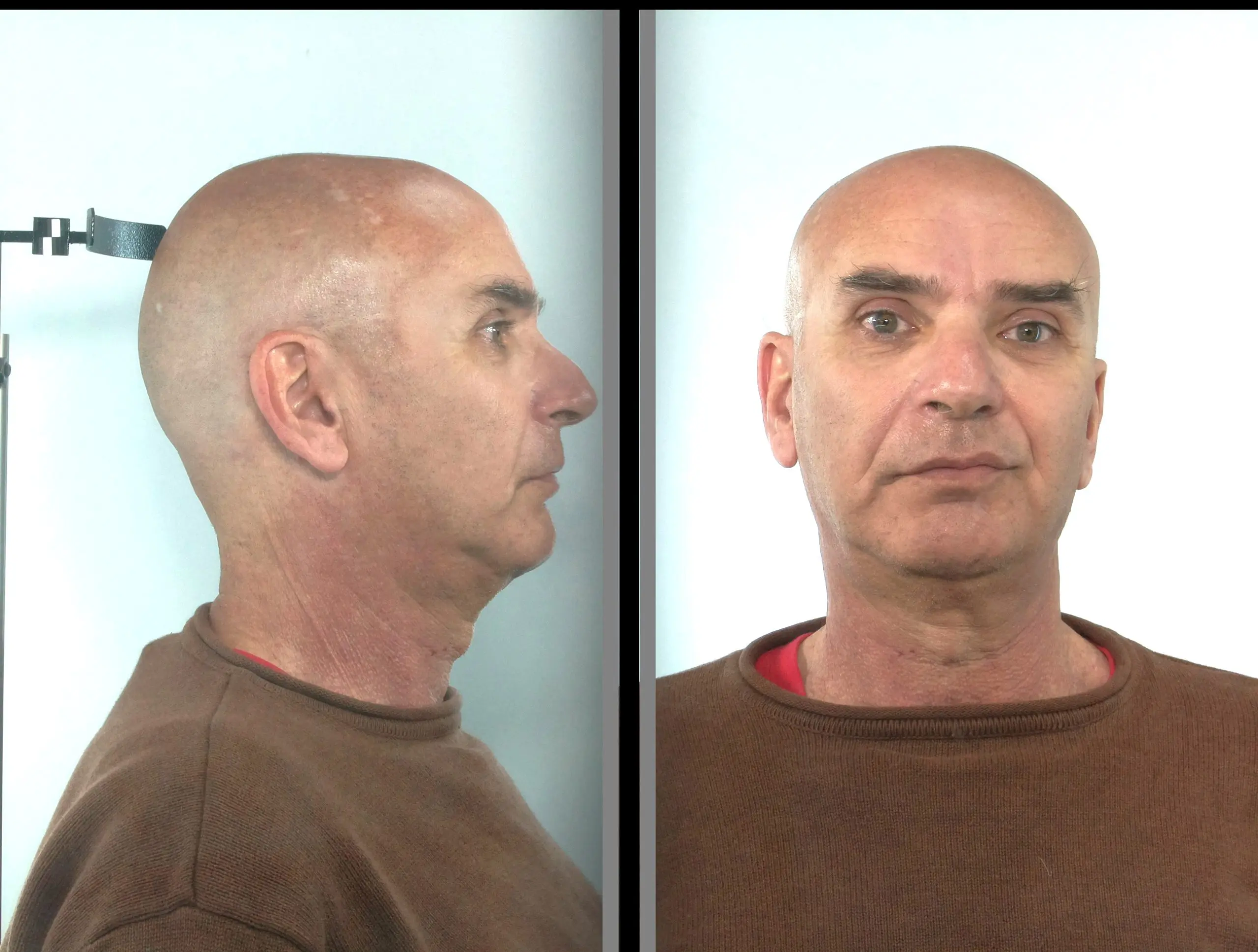 Στη δημοσιότητα τα στοιχεία ενός 58χρονου που κατηγορείται για ασέλγεια εις βάρος ανήλικης με αναπηρία