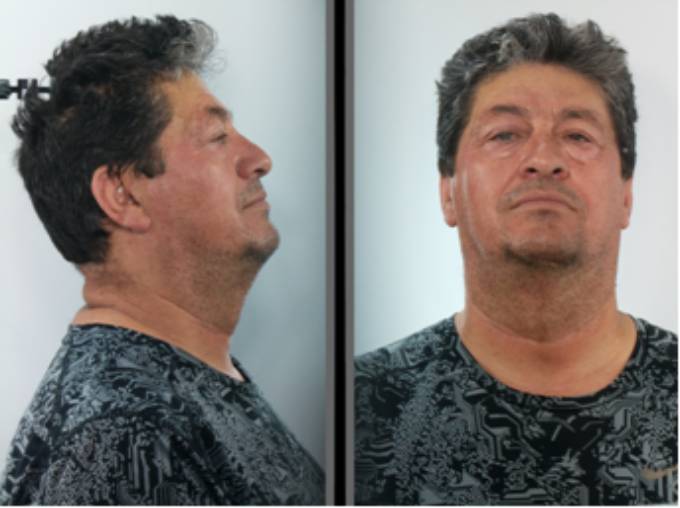 Αυτός είναι ο 63χρονος που βίασε ανήλικο στο Ηράκλειο Κρήτης