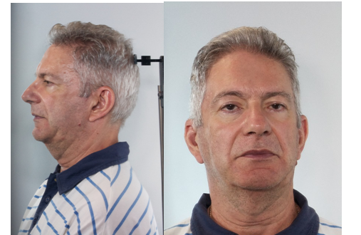 Χανιά: Αυτός είναι ο γιατρός της κατασκήνωσης που ασέλγησε σε παιδιά