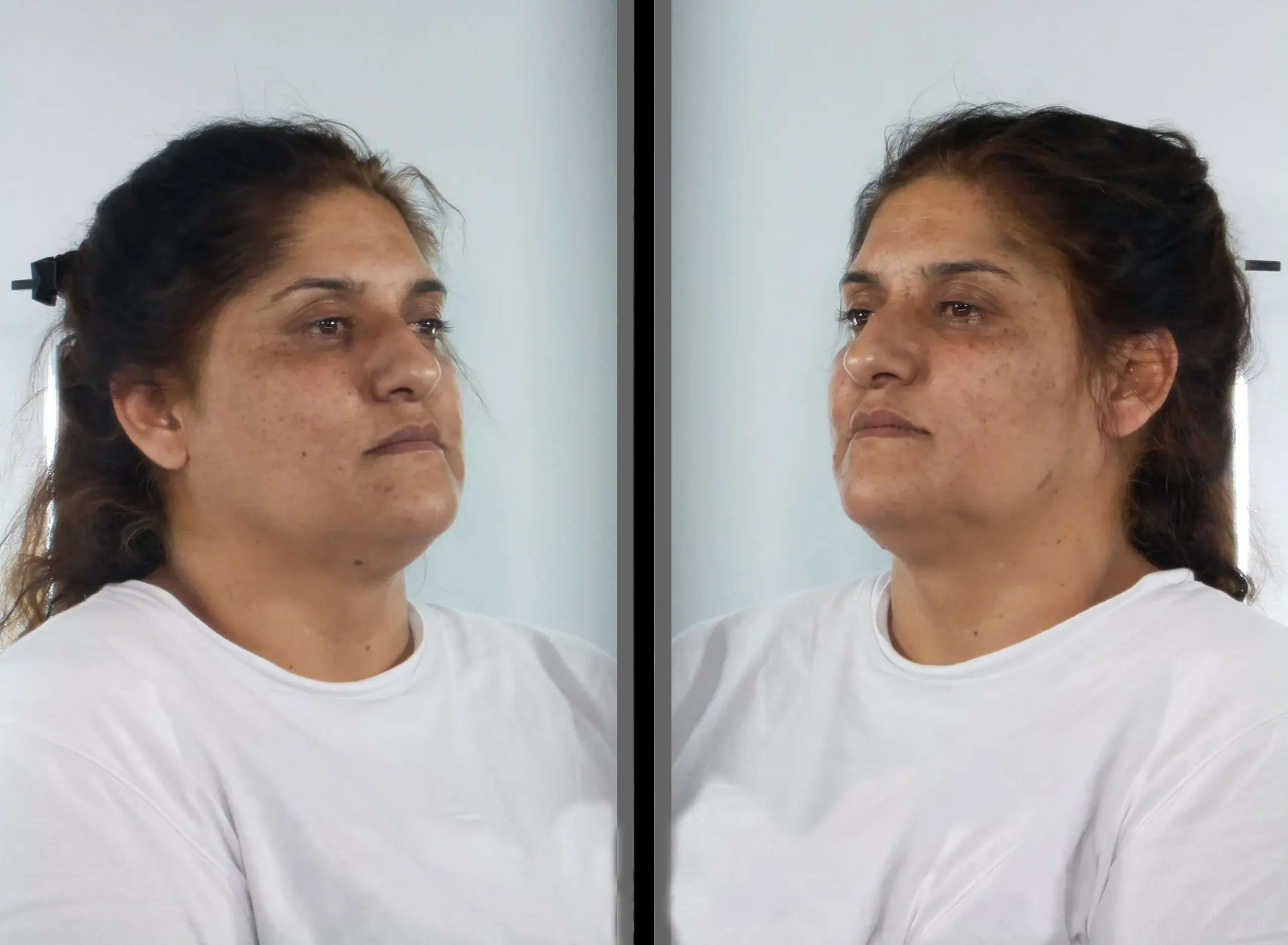 Η 37χρονη που διέπραττε κλοπές με τη μέθοδο του εναγκαλισμού και ληστείες στην ευρύτερη περιοχή του Πειραιά