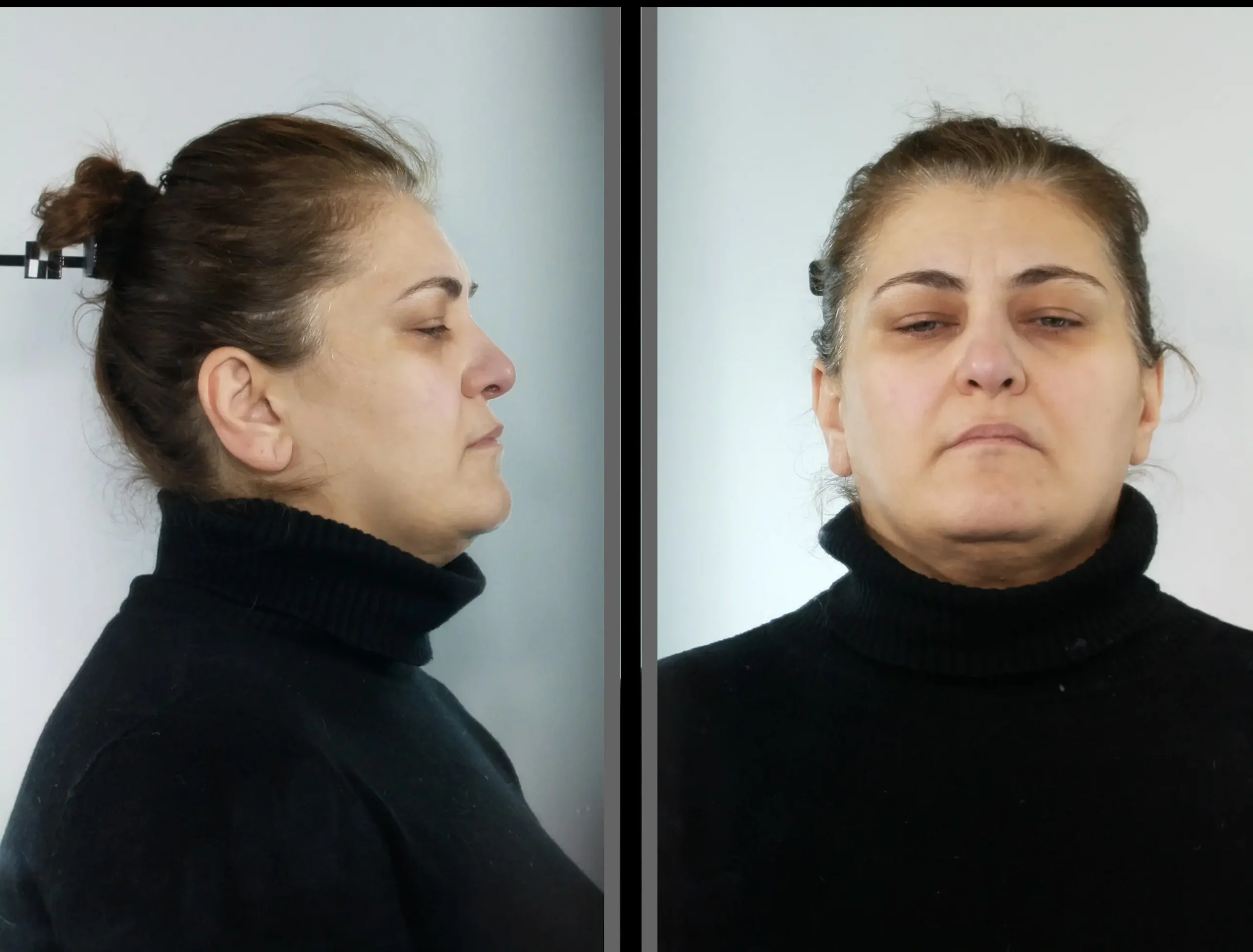 Αυτή είναι η 45χρονη που προσποιούμενη την οικιακή βοηθό έκλεβε κυρίως άτομα με κινητικές ή νοητικές αναπηρίες